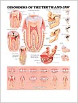顎と歯の疾患