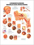中耳感染の知識